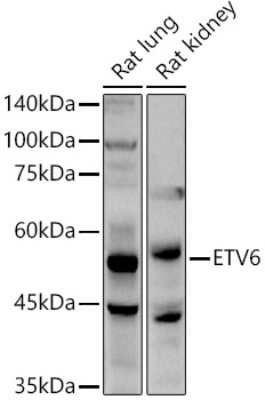 Western Blot: ETV6/Tel AntibodyAzide and BSA Free [NBP3-03435]